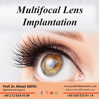 Multifocal Lens