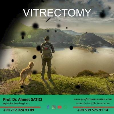 Vitrectomy