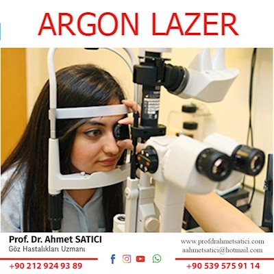 Argon Laser